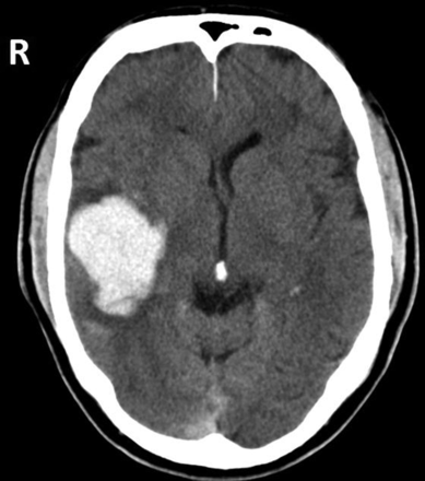 Figure 1